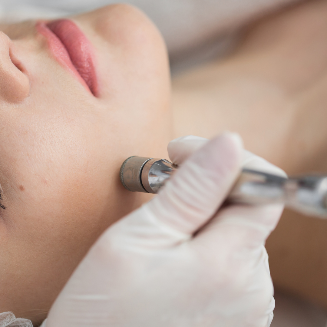 Microdermabrasion Training