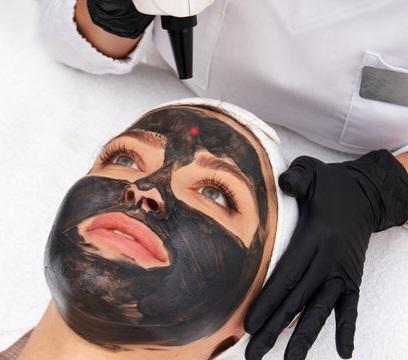 Carbon Peel Laser Training