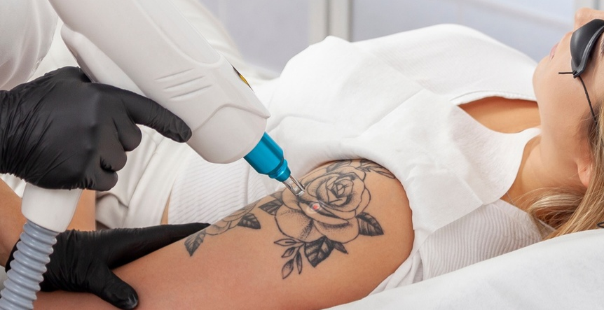 Body Tattoo/Eyebrow Tattoo Laser Removal Training