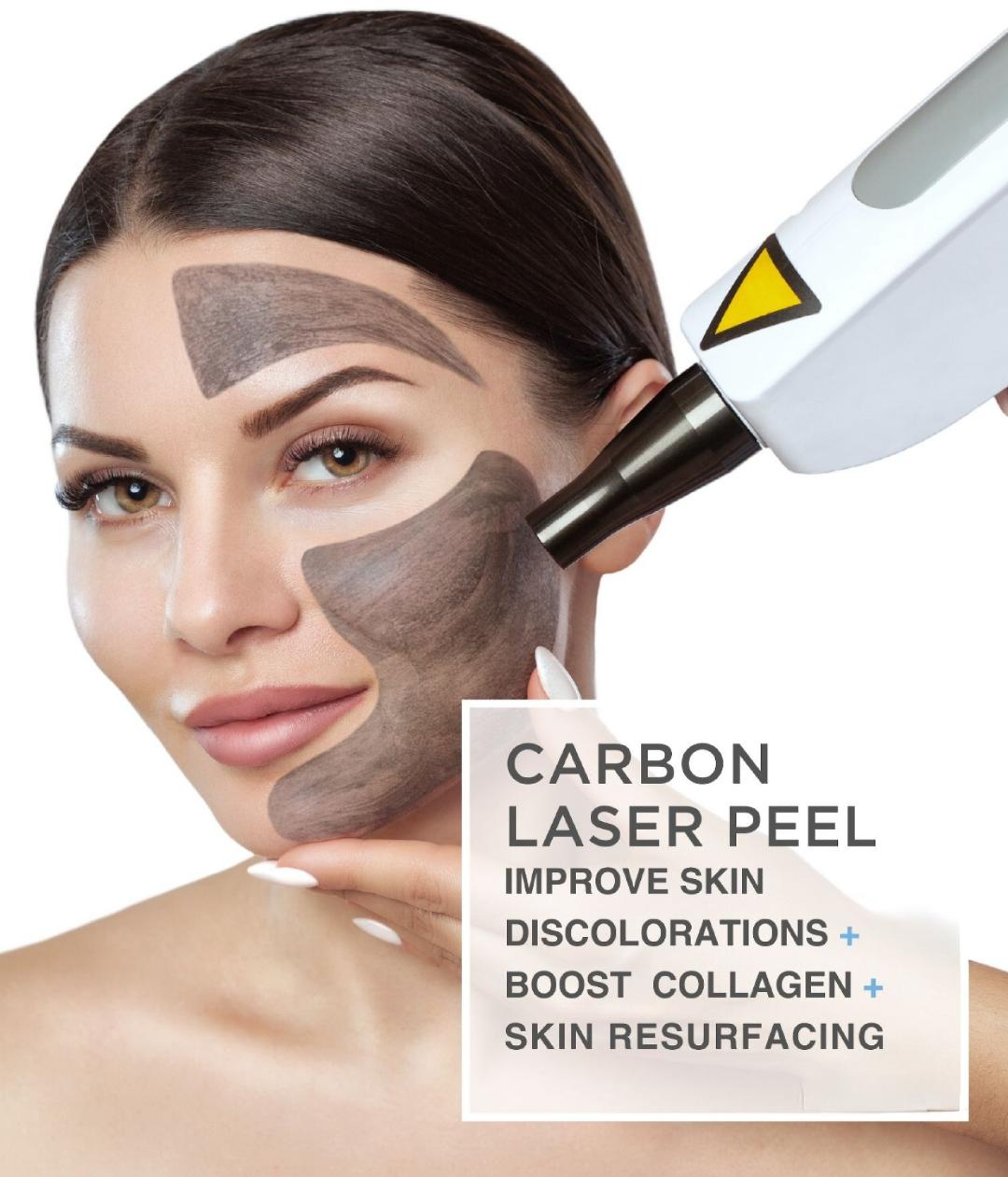 Carbon Peel Laser Training