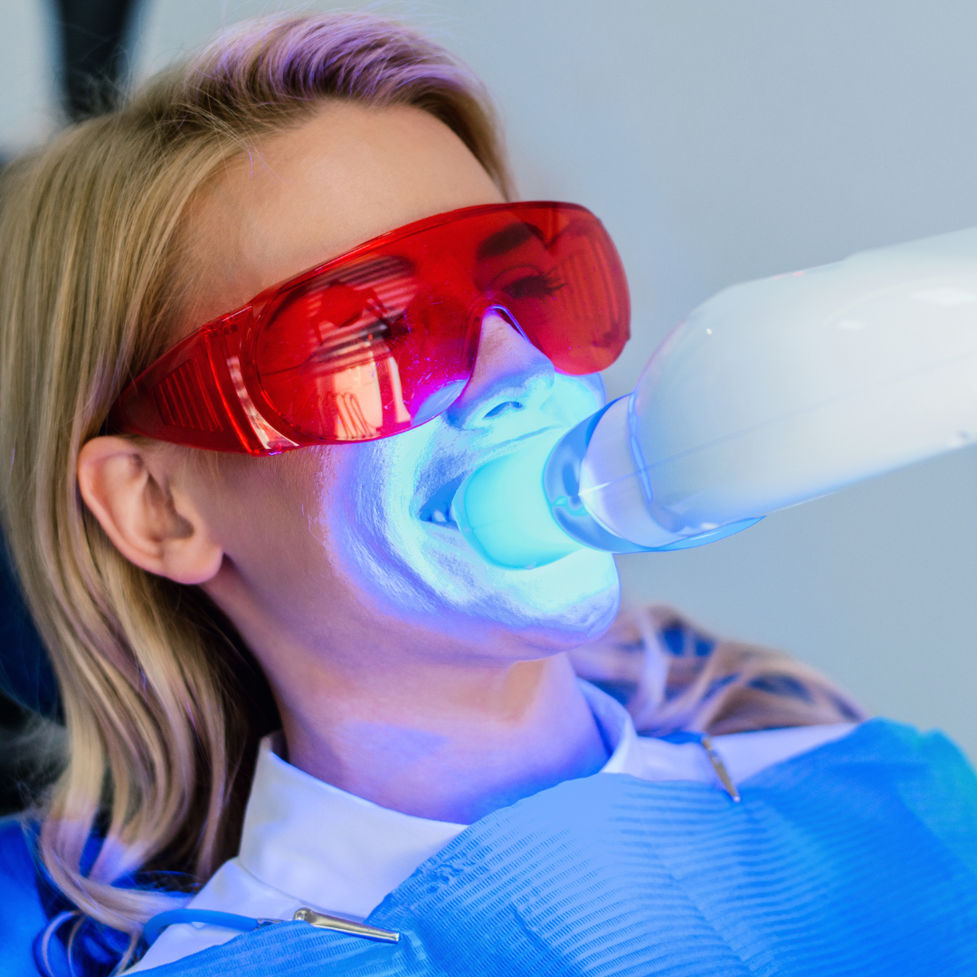 Teeth Whitening Training ( Special Promo )