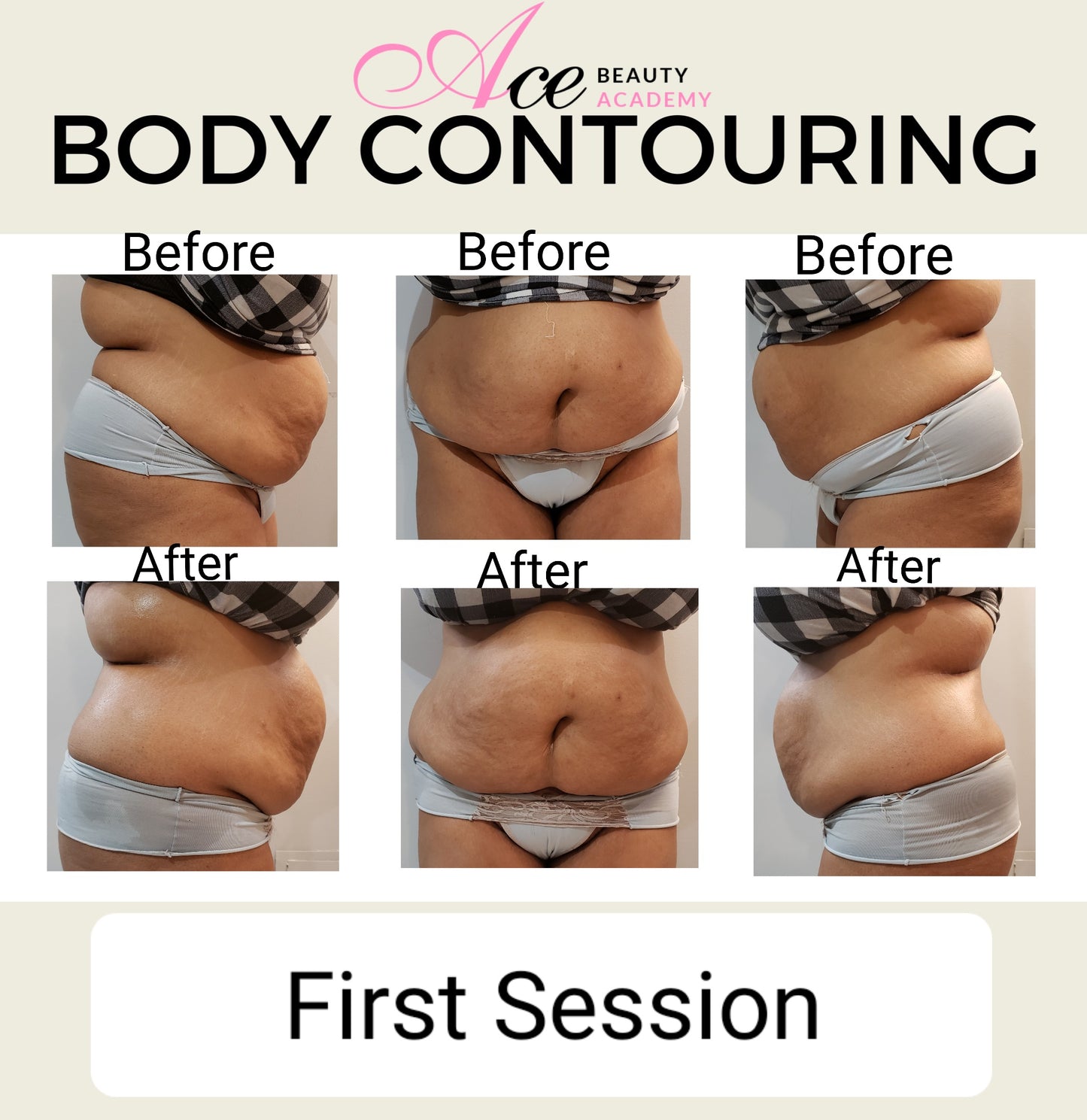 Body Contouring Training ( Special Promo )